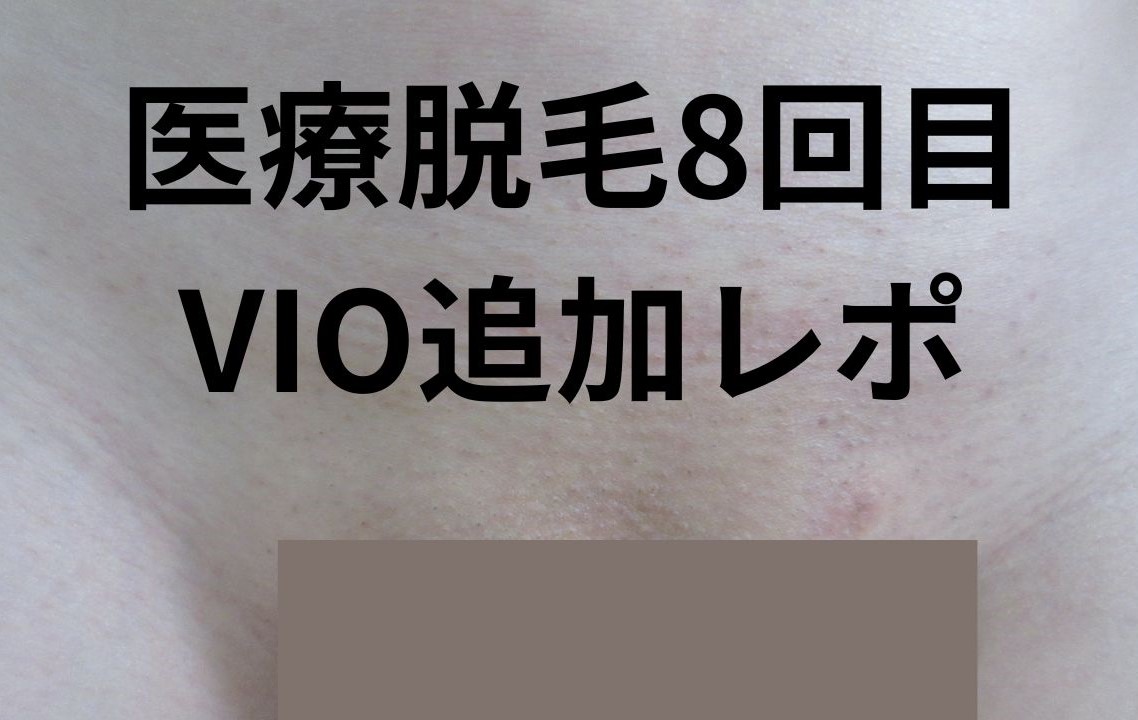 【体験談】医療脱毛8回目！VIO追加レポ（ブランクリニック→湘南美容外科）【写真あり】